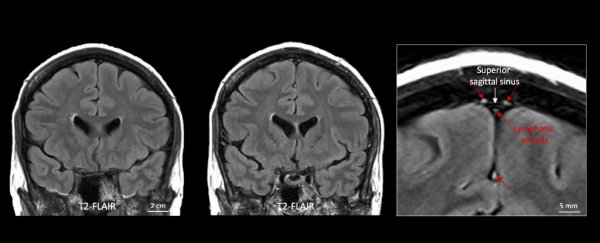 Scientists have finally discovered proof that our brains have a waste drainage system