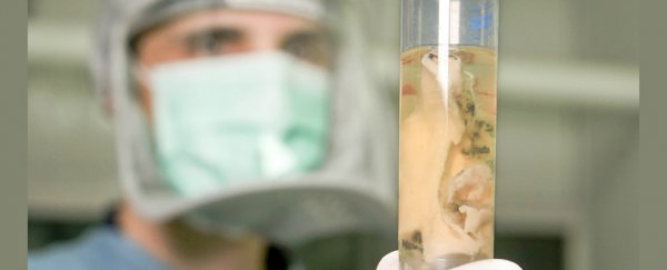 Mad cow disease is still a threat, but we might finally have a blood test for it