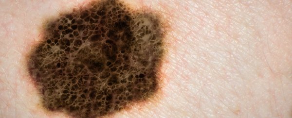 These two drugs can eliminate one in five skin cancer tumours