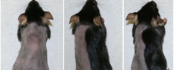 There's a new drug to treat some types of baldness - and it actually works