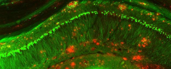 New protein injection reverses Alzheimer’s symptoms in mice in just one week
