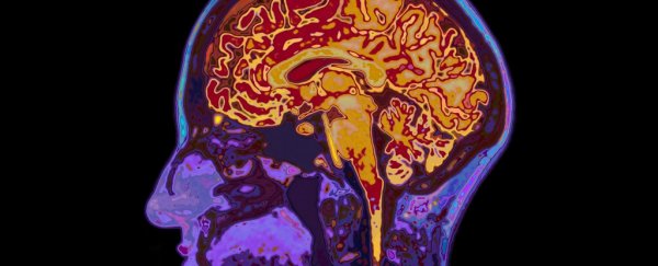 From decapitation to consciousness: how one nerve connects body, brain, and mind