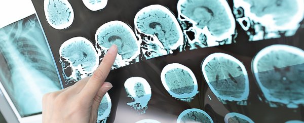 An extreme new treatment has cured patients of MS