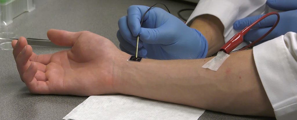 Nanochip on arm