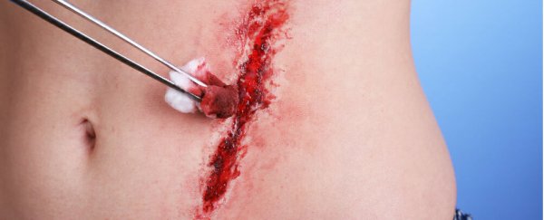 New gel can stop wounds from bleeding
