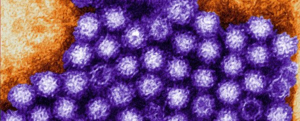 Scientists discover 3 new strains of norovirus that are causing gastro outbreaks