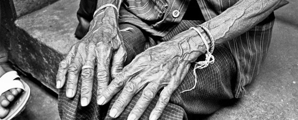 Biologists discover the key mechanism that triggers human ageing