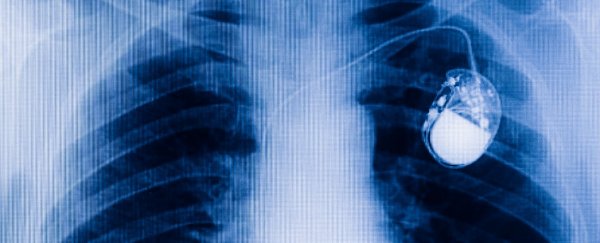 New wireless pacemaker could offer a surgery-free alternative
