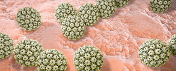 There's a much better option than Pap smears for detecting cancer, evidence shows