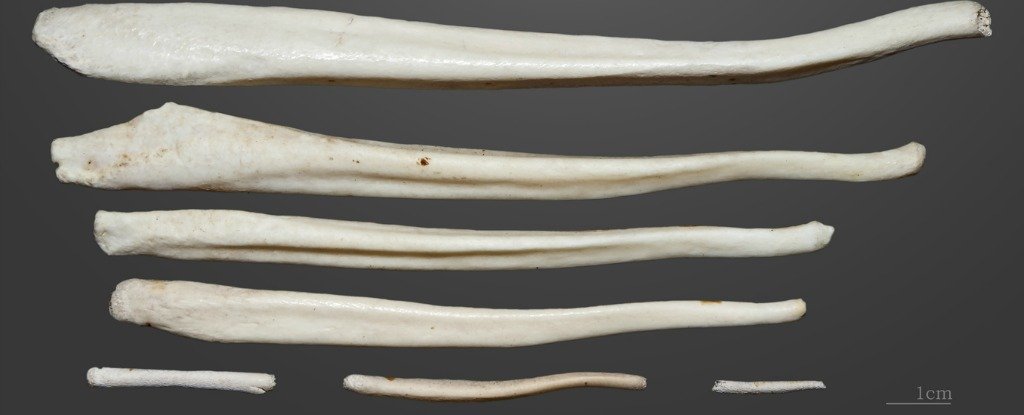 We Might Finally Know Why Humans Lost Their Penis Bones 