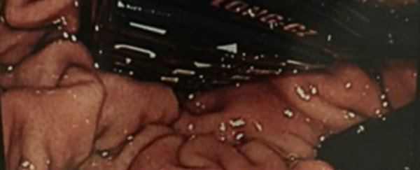Surgeons just removed the world's tiniest phone from a prisoner's stomach