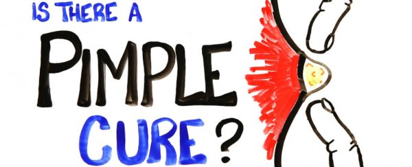WATCH: Is there a cure for pimples?