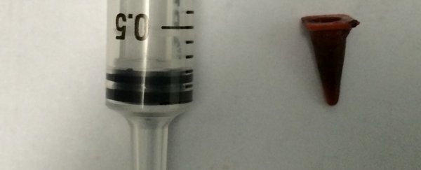 A suspected case of lung cancer turns out to be a toy traffic cone