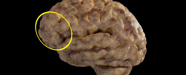 There's now more evidence linking psychopathy to disturbances in the prefrontal cortex