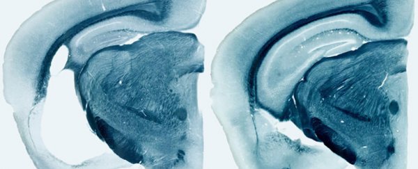 We just found a gene that could radically change our thinking on Alzheimer's