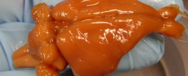 A mammal's brain has been cryonically frozen and recovered for the first time