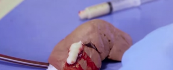 WATCH: This band-aid gel instantly stops bleeding
