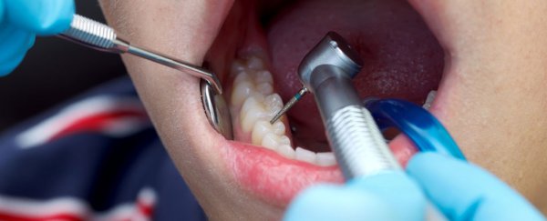 Study of 'No Drill' Dentistry Shows Fillings Aren't Needed in Many Cases