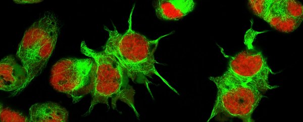 External factors contribute heavily to cancer, study finds, but scientists are divided
