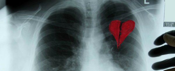 Can you really die from a broken heart?