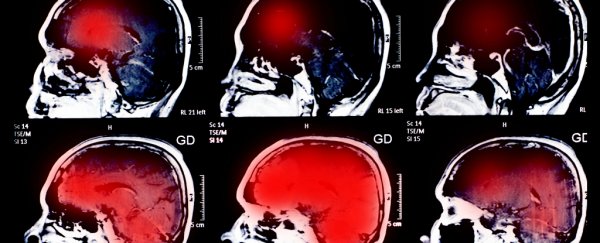Scientists find that bigger brains aren't necessarily smarter