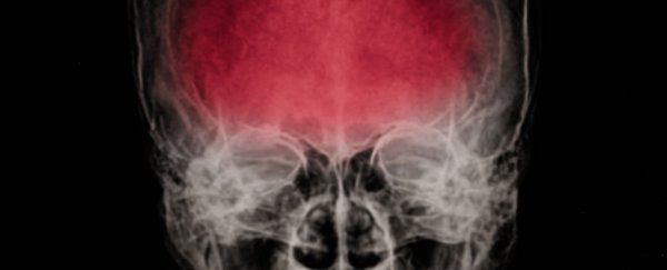 Early treatment for brain inflammation could prevent schizophrenia, study finds