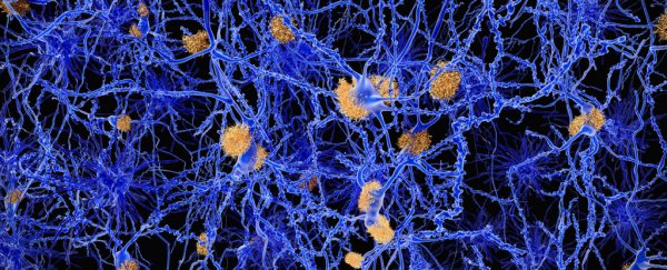 Scientists discover chemical that breaks down Alzheimer's plaques in mice