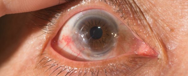 Researchers may have discovered a way to reverse untreatable blindness