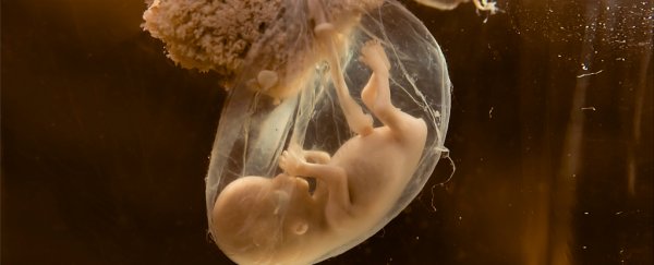 First uterus transplants to begin in the US to help infertile women