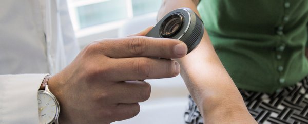 Artificial intelligence can now identify skin cancer as accurately as experts