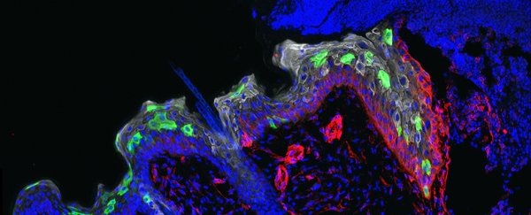 Our skin can 'remember' inflammation, and it could help us understand psoriasis