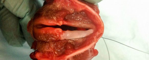 Scientists have grown functioning vocal cord tissue for the first time