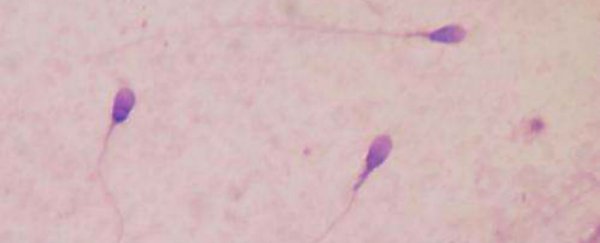 Scientists have just made sperm out of human skin cells