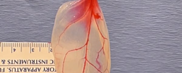 Scientists have turned spinach into beating human heart tissue