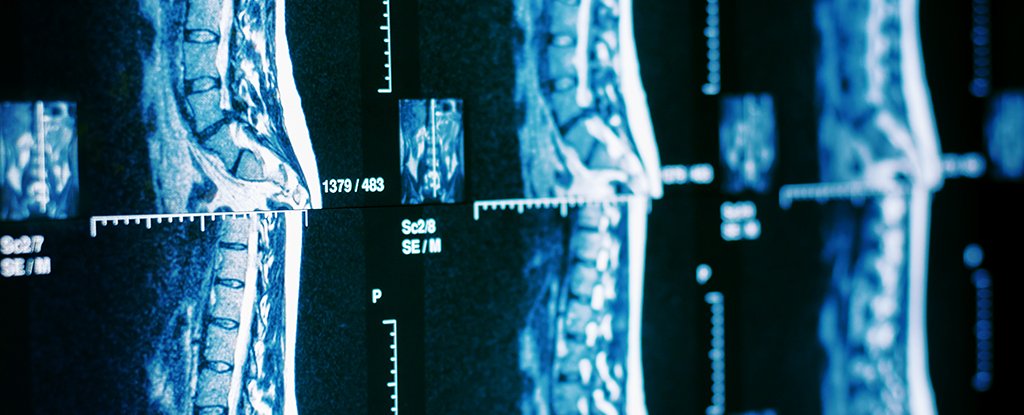 We're finally understanding how we can repair spinal cord injuries
