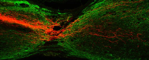 Stem cells have been used to regenerate damaged spinal cords in rats