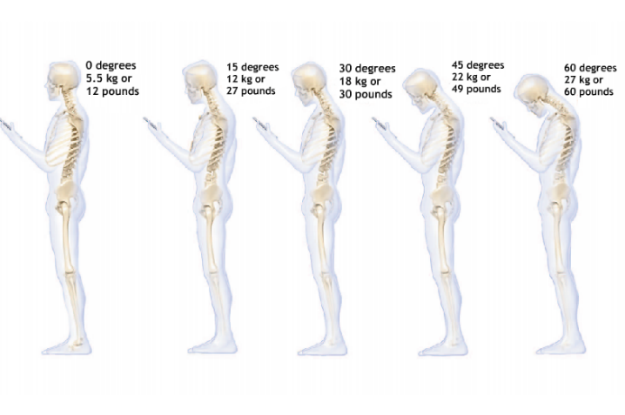 Www Sciencealert Images Articles Processed Spi