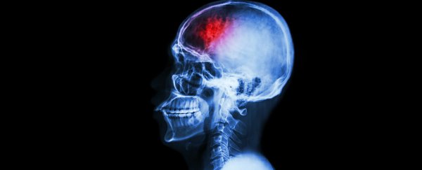 Researchers find gut bacteria can trigger brain lesions that lead to strokes