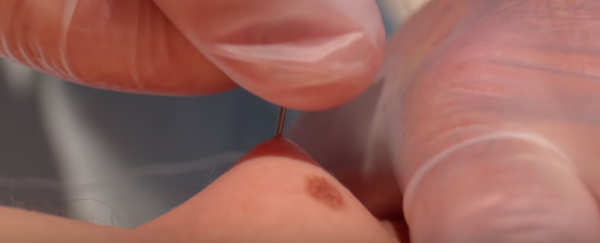 Watch: Bare skin gets tasered at 28,000 frames per second