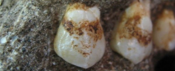 Sorry guys, our early human ancestors didn't have insane, wood-eating jaws