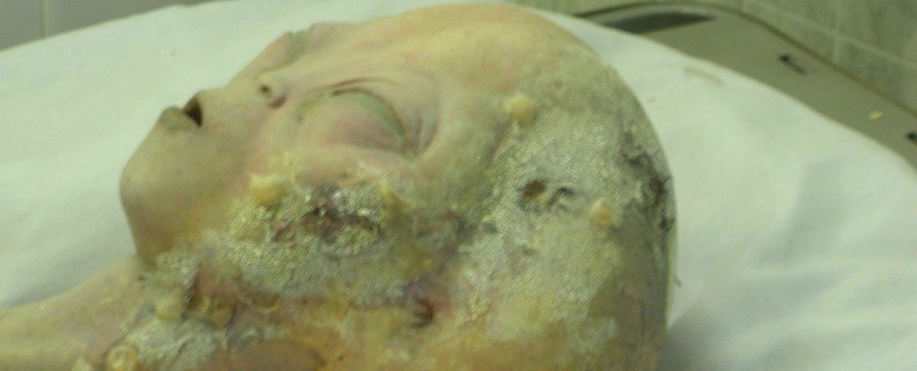 10 Scientific Hoaxes That The World Totally Fell For