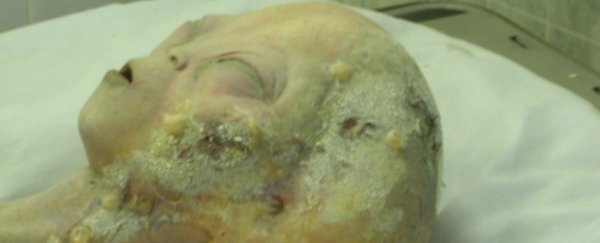 10 scientific hoaxes that the world totally fell for