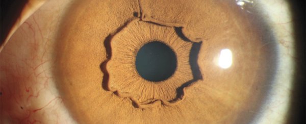 There's a simple explanation for this super creepy eyeball
