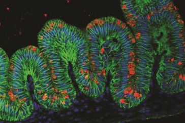 Scientists use stem cells to grow tiny human stomachs