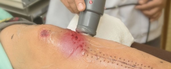 This new medical device can improve healing rates by 30%