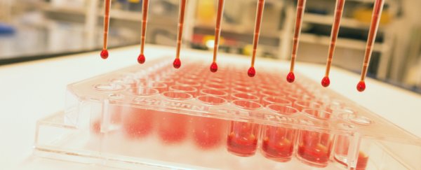 This new method for testing blood with sound waves is insanely clever