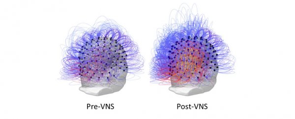 Doctors restore consciousness in man who spent 15 years in a vegetative state