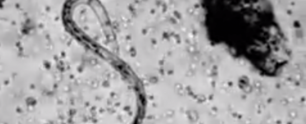 WATCH: This is what your immune response looks like