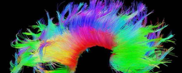 The brains of high achievers are wired differently, study finds