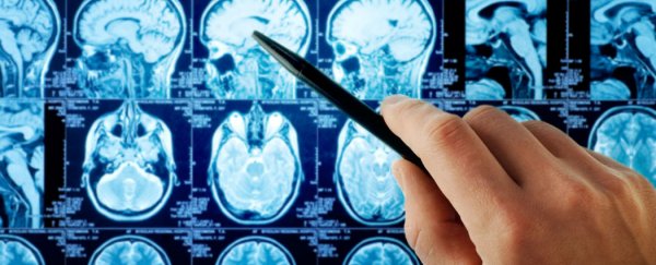 Women's brains are more vulnerable to Alzheimer's than men’s, studies suggest